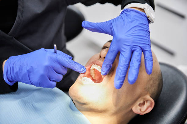 Best Urgent Care for Lost Fillings or Crowns in Topton, PA